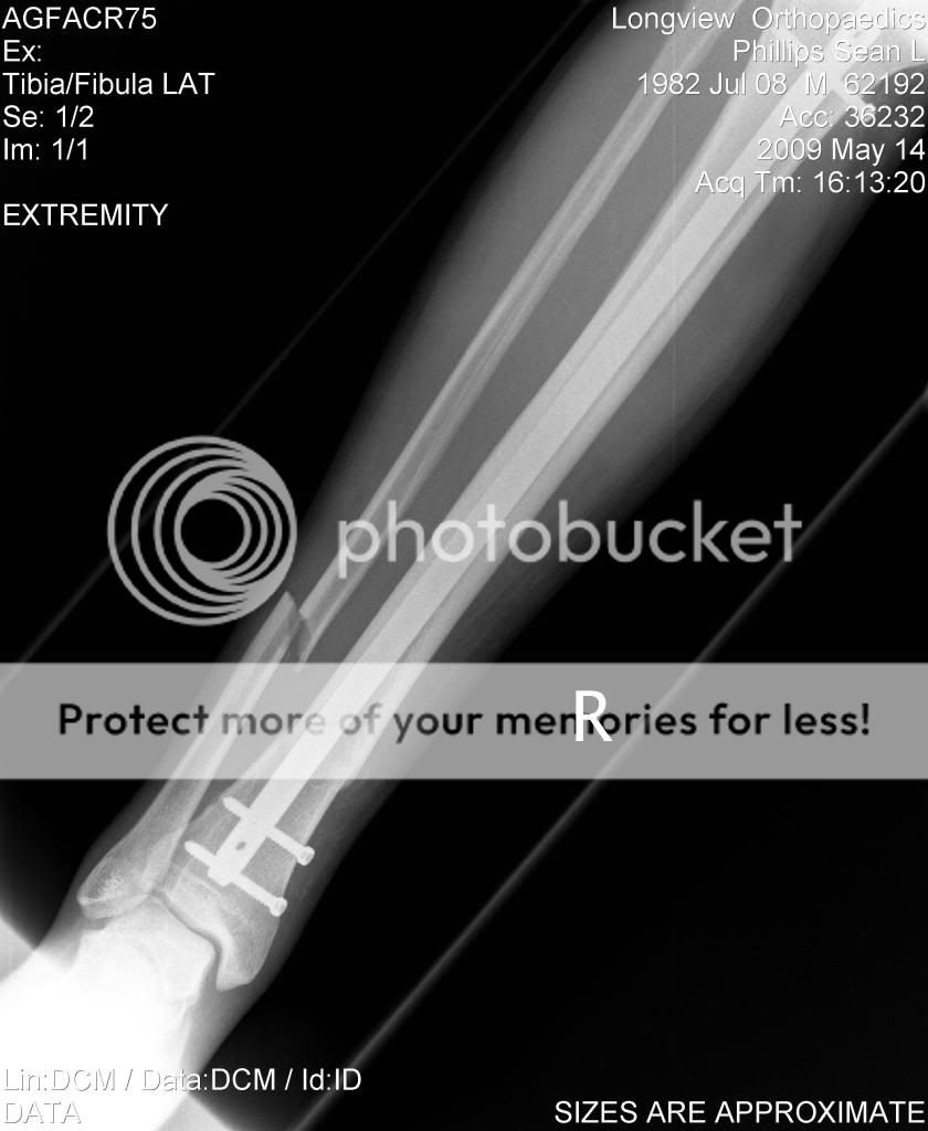 Tom Plamondon PA-C - Tue Jun 09...